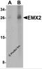 EMX2 antibody, 6627, ProSci, Western Blot image 