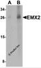 Empty Spiracles Homeobox 2 antibody, 6627, ProSci, Western Blot image 