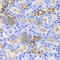 Diaphanous Related Formin 1 antibody, A5772, ABclonal Technology, Immunohistochemistry paraffin image 