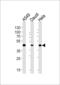 Aldehyde Dehydrogenase 3 Family Member A1 antibody, LS-C97161, Lifespan Biosciences, Western Blot image 