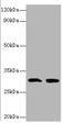 Interleukin 1 Beta antibody, A53690-100, Epigentek, Western Blot image 