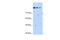 SET Domain Containing 2, Histone Lysine Methyltransferase antibody, 30-305, ProSci, Western Blot image 