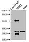 Thiopurine S-Methyltransferase antibody, LS-B10634, Lifespan Biosciences, Immunoprecipitation image 