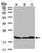 Stathmin 1 antibody, LS-B4830, Lifespan Biosciences, Western Blot image 