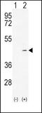 Alcohol Dehydrogenase 4 (Class II), Pi Polypeptide antibody, PA5-23637, Invitrogen Antibodies, Western Blot image 