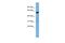 Phosphatidylserine Synthase 2 antibody, A09911, Boster Biological Technology, Western Blot image 