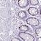 Zinc Finger And BTB Domain Containing 8B antibody, NBP2-46826, Novus Biologicals, Immunohistochemistry frozen image 