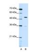 Zinc Finger Protein 485 antibody, NBP1-80400, Novus Biologicals, Western Blot image 