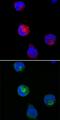 Synaptosome Associated Protein 29 antibody, AF7869, R&D Systems, Immunocytochemistry image 