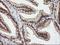 Nudix Hydrolase 9 antibody, NBP2-01072, Novus Biologicals, Immunohistochemistry paraffin image 