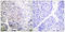 Aurora Kinase B antibody, LS-C198661, Lifespan Biosciences, Immunohistochemistry paraffin image 