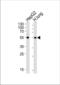 Aldehyde Dehydrogenase 1 Family Member A1 antibody, TA324559, Origene, Western Blot image 
