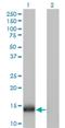 Interferon Induced Transmembrane Protein 1 antibody, H00008519-M01, Novus Biologicals, Western Blot image 