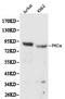 Protein Kinase C Alpha antibody, orb129720, Biorbyt, Western Blot image 