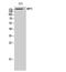 ATP Binding Cassette Subfamily C Member 2 antibody, STJ94205, St John