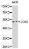 Damage Specific DNA Binding Protein 2 antibody, orb48351, Biorbyt, Western Blot image 