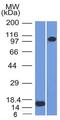 Thrombomodulin antibody, GTX35108, GeneTex, Western Blot image 