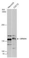 SURP And G-Patch Domain Containing 2 antibody, GTX129798, GeneTex, Western Blot image 