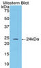 Angiopoietin 1 antibody, LS-C304107, Lifespan Biosciences, Western Blot image 