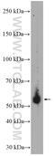 Hereditary hemochromatosis protein antibody, 17954-1-AP, Proteintech Group, Western Blot image 