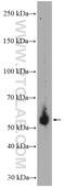 Homeostatic Iron Regulator antibody, 17954-1-AP, Proteintech Group, Western Blot image 