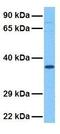 Poly(RC) Binding Protein 1 antibody, GTX47349, GeneTex, Western Blot image 