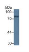 Neurofilament Light antibody, LS-C295582, Lifespan Biosciences, Western Blot image 