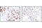 Phosphatase And Tensin Homolog antibody, 9559T, Cell Signaling Technology, Immunohistochemistry paraffin image 