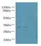 Tetraspanin 5 antibody, LS-C376943, Lifespan Biosciences, Western Blot image 