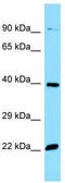 Olfactory Receptor Family 51 Subfamily E Member 2 antibody, TA337961, Origene, Western Blot image 