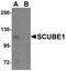 Signal Peptide, CUB Domain And EGF Like Domain Containing 1 antibody, TA320028, Origene, Western Blot image 