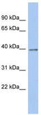 Zinc Finger Protein 670 antibody, TA341432, Origene, Western Blot image 