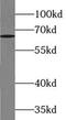 Zinc Finger And BTB Domain Containing 46 antibody, FNab09596, FineTest, Western Blot image 