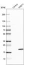 Single-Pass Membrane Protein With Aspartate Rich Tail 1 antibody, HPA032117, Atlas Antibodies, Western Blot image 