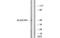 Transmembrane Protein 237 antibody, MBS5301329, MyBioSource, Western Blot image 