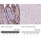 Cadherin 1 antibody, AMAb90865, Atlas Antibodies, Immunohistochemistry paraffin image 