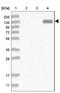 Myomesin 3 antibody, NBP1-81960, Novus Biologicals, Western Blot image 