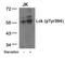 LCK Proto-Oncogene, Src Family Tyrosine Kinase antibody, GTX50202, GeneTex, Western Blot image 