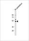 TRNA Aspartic Acid Methyltransferase 1 antibody, 55-093, ProSci, Western Blot image 