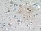 Kelch Like Family Member 4 antibody, 21191-1-AP, Proteintech Group, Immunohistochemistry frozen image 