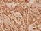 Collagen Type I Alpha 2 Chain antibody, A00624S3, Boster Biological Technology, Immunohistochemistry frozen image 