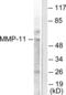 Matrix Metallopeptidase 11 antibody, LS-B5662, Lifespan Biosciences, Western Blot image 