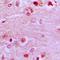 Enhancer Of Zeste 1 Polycomb Repressive Complex 2 Subunit antibody, LS-C352173, Lifespan Biosciences, Immunohistochemistry frozen image 