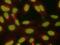 Forkhead Box M1 antibody, AF3975, R&D Systems, Immunocytochemistry image 