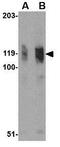ADAP antibody, GTX31762, GeneTex, Western Blot image 