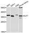 Kruppel Like Factor 7 antibody, STJ113594, St John