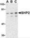 Protein Tyrosine Phosphatase Non-Receptor Type 11 antibody, 3901, ProSci, Western Blot image 