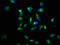 Lymphotoxin Beta Receptor antibody, LS-C678535, Lifespan Biosciences, Immunofluorescence image 