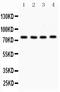 Protein Kinase C Alpha antibody, LS-C357510, Lifespan Biosciences, Western Blot image 