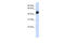 Transcription Factor AP-2 Beta antibody, 27-112, ProSci, Western Blot image 